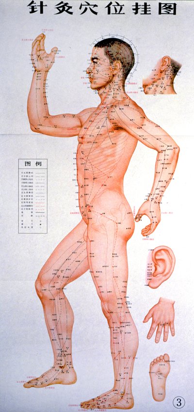 Acupuncture by Unknown Artist