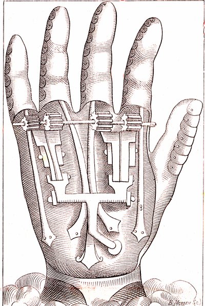 Artificial Hand Prosthesis by the French Surgeon Anatomist Ambroise Paré by Unknown artist