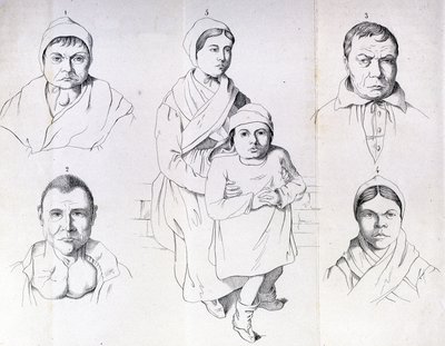 Considerations on the causes of endemic cretinism by Morel by Unknown artist
