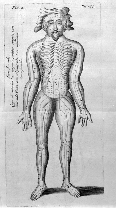 De Acupunctura by W.Ten Rhijne. London 1683. First Western text dealing with Acupuncture. by Unknown artist