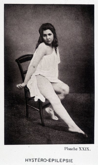 Hystero Epilepsie - Contracture in “Photographic iconography of the Salpêtrière: service of Mr. Charcot” by Paul Regnard and Bourneville by Unknown artist