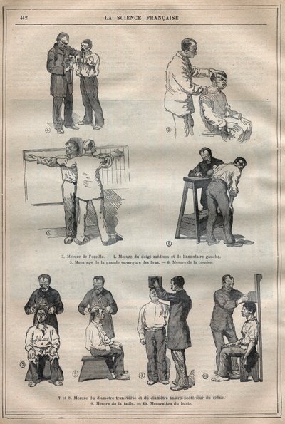 Judicial Anthropometry or Bertillonage, Method of Alphonse Bertillon - Engraving in 