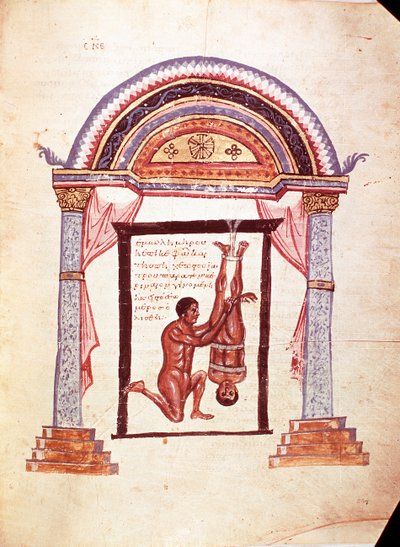 Medicine: reduction of a dislocated knee, the patient is suspended by the feet by Unknown artist