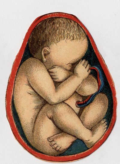 Representation of a uterus with pregnancy. 
