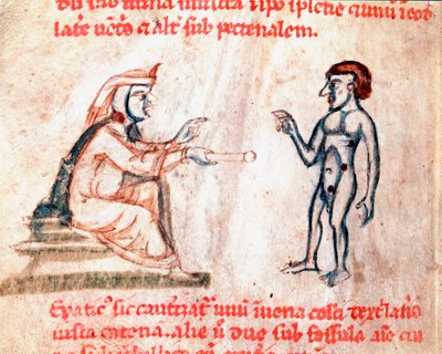 The doctor burns the patient on painful areas with hot irons (Miniature from the manuscript De Medicina cauteriorum secundum Brunum, Rugerium et Rolthe, 13th century) by Unknown artist