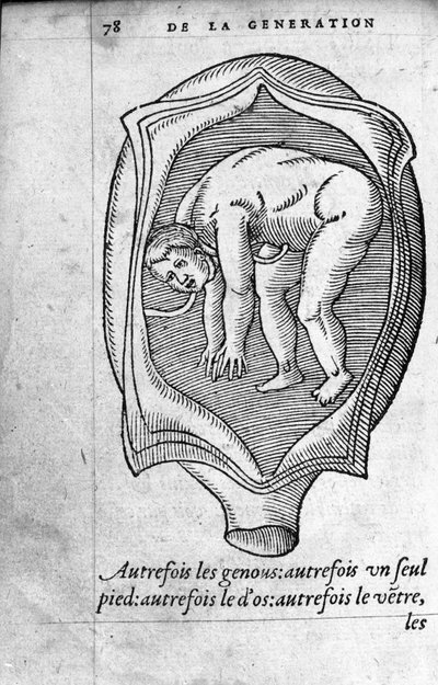 The Position of the Fetus in the Uterus by Unknown artist