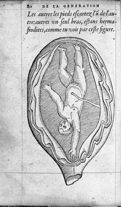 The Position of the Fetus in the Uterus During Pregnancy. Engraving from 