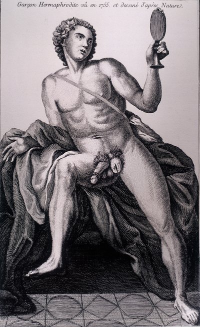 Hermaphrodite Boy Seen in 1755 and Drawn from Nature by Unknown artist