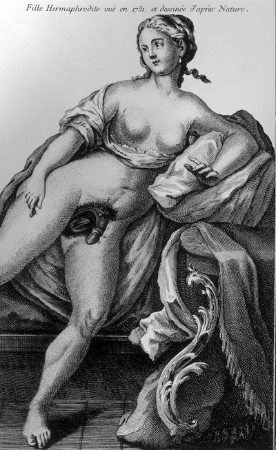Hermaphrodite Girl Seen in 1751 and Drawn from Nature by Unknown artist