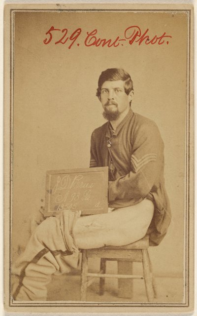 J.D. Brua, 93rd Pennsylvania, Civil War Victim by Unknown artist