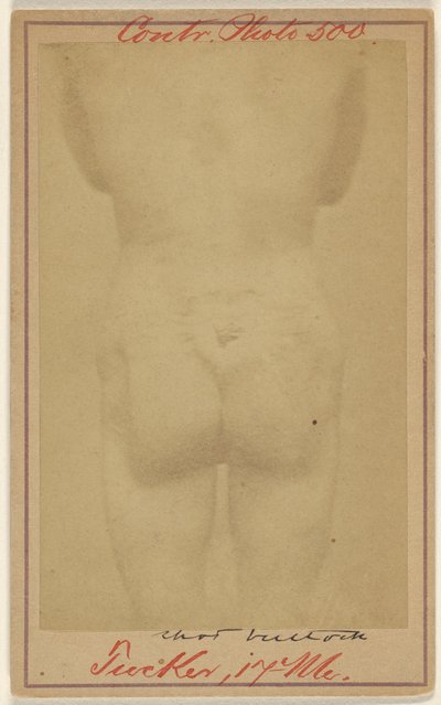 Jno. E. Tucker, Shot in the Buttocks, Civil War Victim by Unknown artist