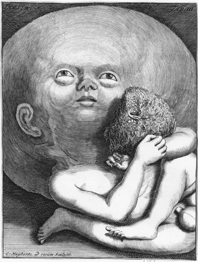 Monster: Child with Hydrocephalus, late 18th century by Unknown artist