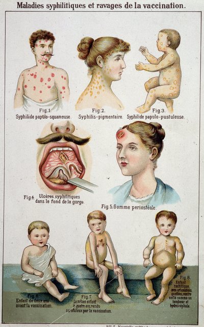 Plate illustrating the different forms of syphilitic diseases and the dangers of vaccination in 