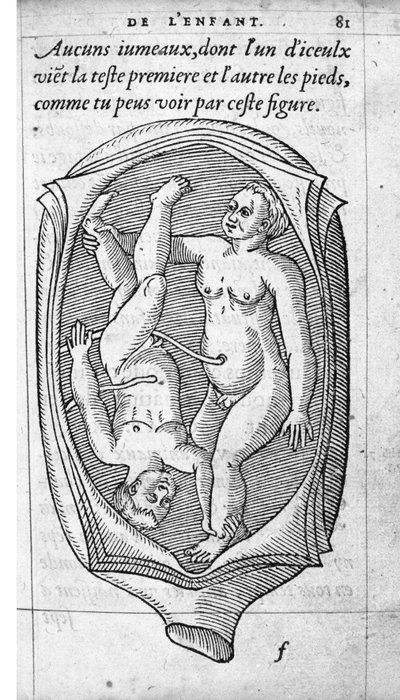 The position of the fetus in the uterus during pregnancy. Engraving from “De la generation des enfants” by French doctor and surgeon Ambroise Pare (1509-1590) 16th century by Unknown artist