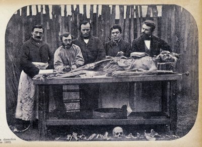 Dissection, c.1865 by Unknown photographer