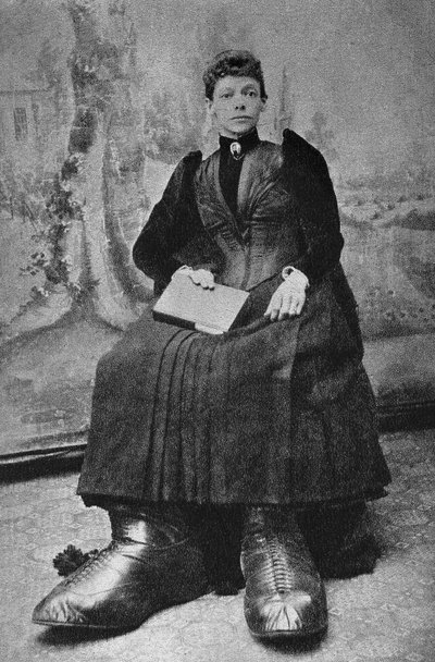 Les Monstres, Berthe aux Grands Pieds. Photography, Late 19th Century, Paris. Coll. Selva. by Unknown photographer