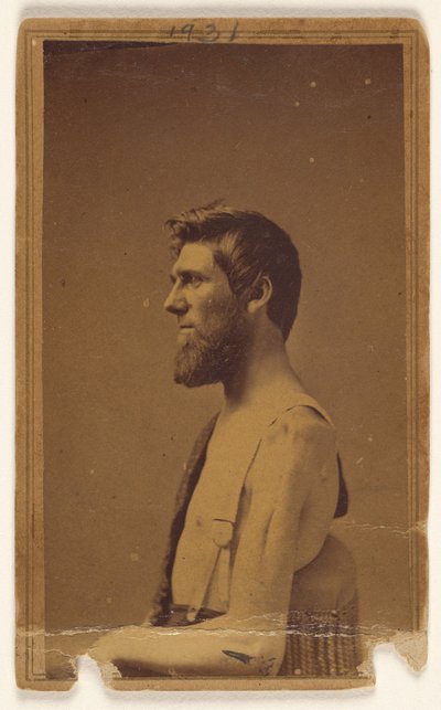 Unidentified Civil War Victim in Profile, Seated by William H. Bell