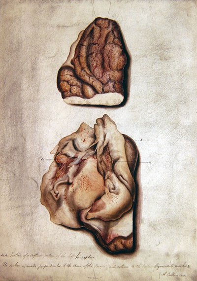 Study of Brain III, c.1850 by William Lover
