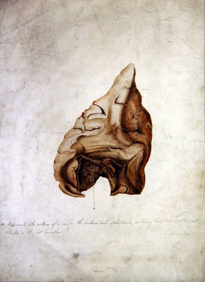 Study of Brain I, c.1850 by William Lover
