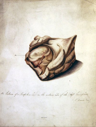 Study of the Brain II, c.1850 by William Lover
