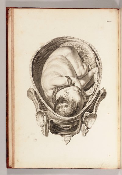 Engraving of a Child in the Womb from 