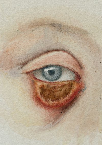 Eyes by Frederick (attr. to) Barnard