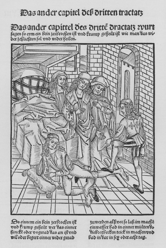 The Book of Cirurgia by Hieronymus Brunschwig by (after) German School
