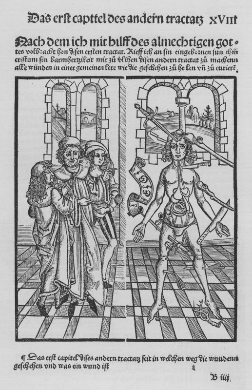 The Book of Cirurgia by Hieronymus Brunschwig by (after) German School