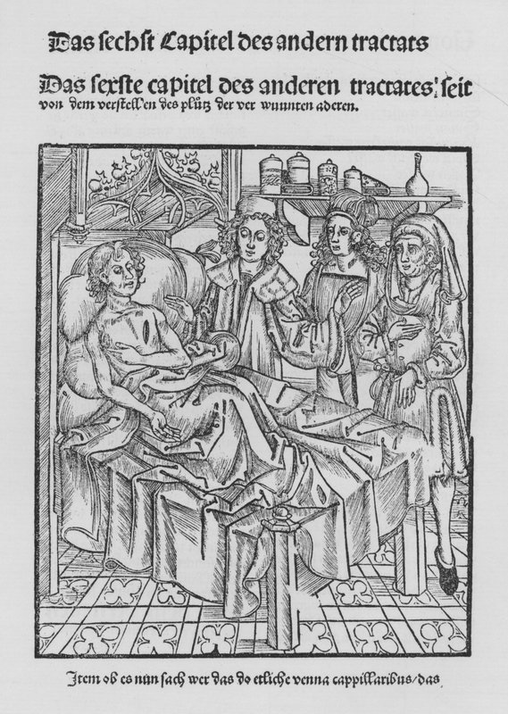 The Book of Cirurgia by Hieronymus Brunschwig by (after) German School