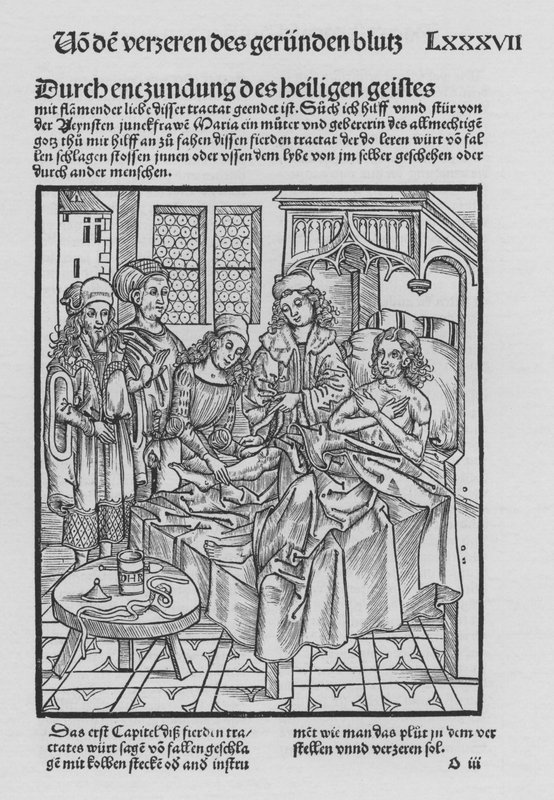 The Book of Cirurgia by Hieronymus Brunschwig by (after) German School