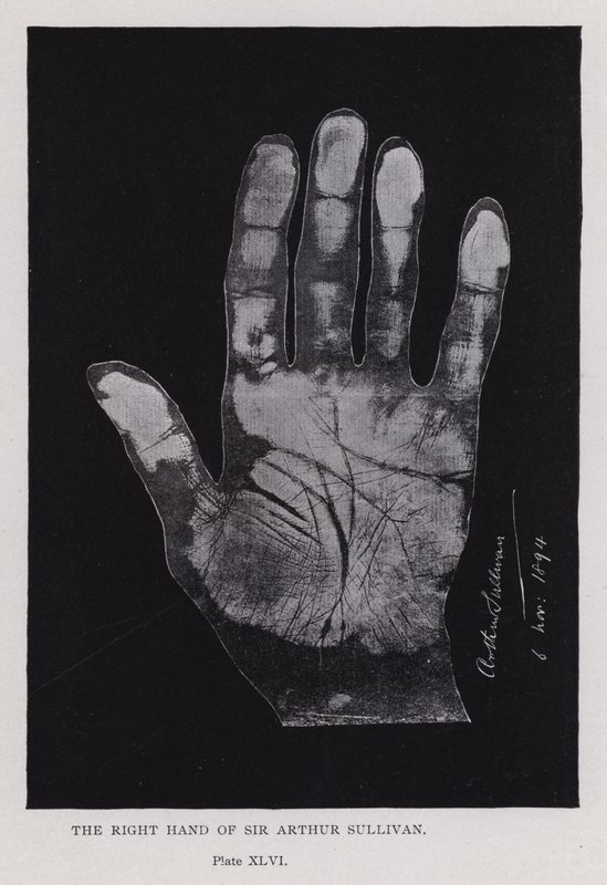The right hand of Sir Arthur Sullivan by English Photographer
