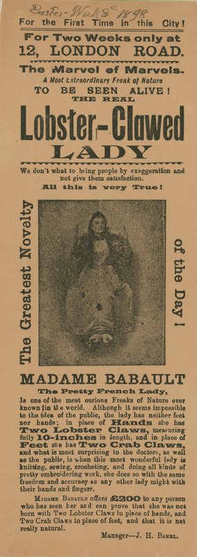 Advert for an Appearance of Madame Babault, the Lobster-Clawed Lady by English School