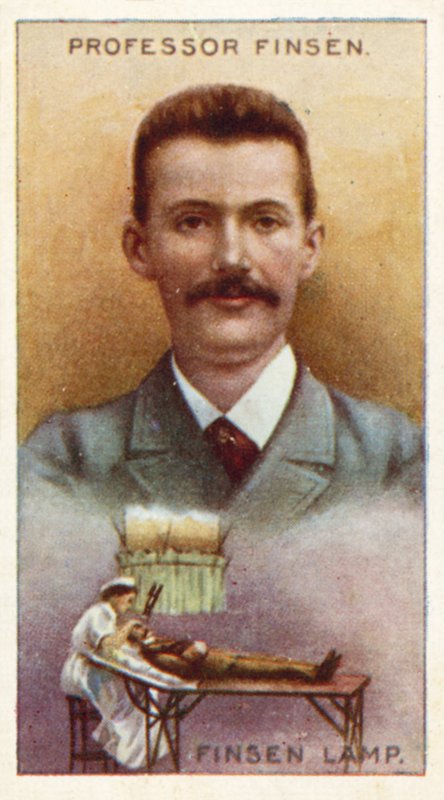 Professor Finsen, Finsen Lamp by English School