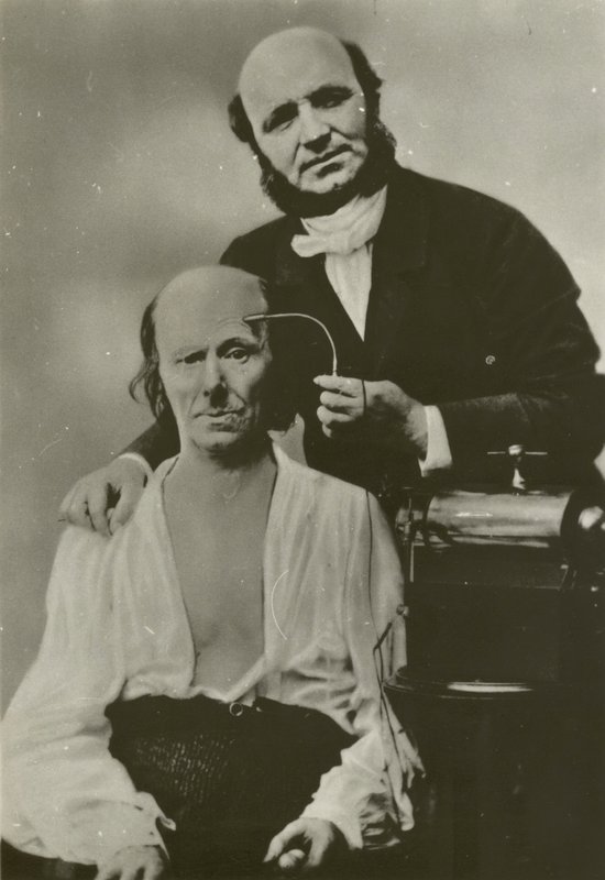 French neurologist Duchenne de Boulogne using his electrophysiology apparatus on an old man by Guillaume Benjamin Armand Duchenne de Boulogne