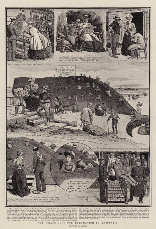 The Whale Cure for Rheumatism in Australia by William Ralston