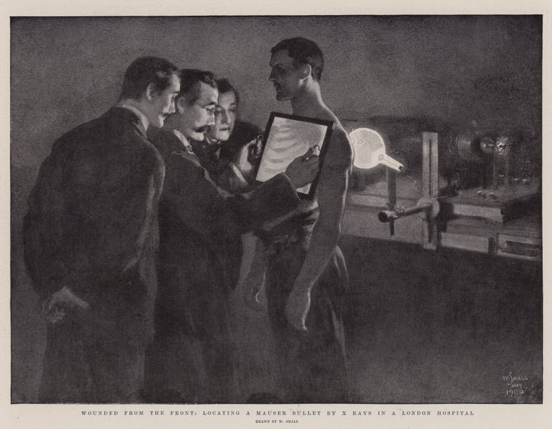Wounded from the Front, locating a Mauser Bullet by X Rays in a London Hospital by William Small