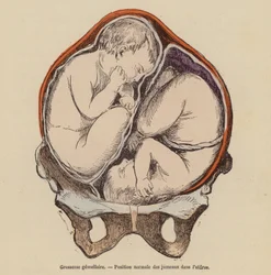 Normal Position of Twins in the Womb During Pregnancy