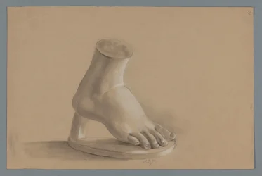 Plaster Model of a Foot