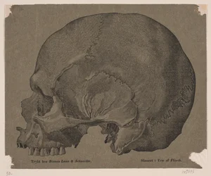 Skull