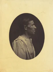 A portrait, seen in profile, of a man 42 years old, stupefied by the abuse of alcohol, 1854-1856