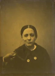 Slight Lowering of the Angle of the Mouth Due to Depression Left, False Laughter Right, 1854-185