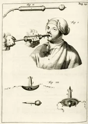 Using a syringe to deliver a purge, from Exercitationes Practicae circa Medendi Methodum by Frederik Dekkers, 1694