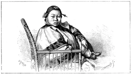 Woman with Bound Feet, China