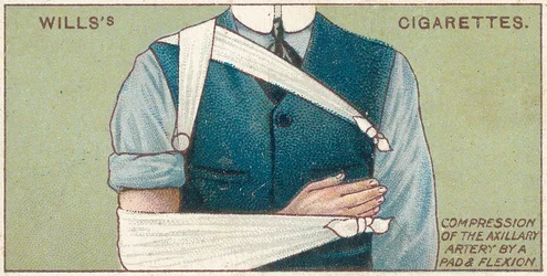 Compression of the Axillary Artery by a Pad and Flexion, no.41 from the First Aid series of Wills Cigarettes cards, 1913