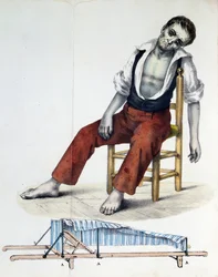 Cholera Morbus, from Relacao, Historica, Statistica e Medica da Cholera-Morbus by Francisco d