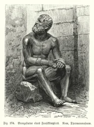 Ancient Greek or Roman Bronze Statue of a Seated Boxer