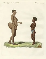 Strange human varieties
