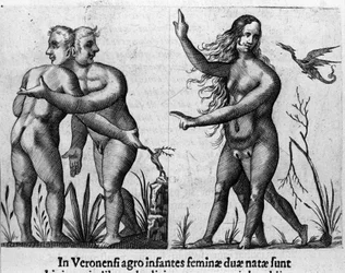 Different types of human monsters: a man with double bodies and heads and a woman with four legs and two sexes. Engraving from “De monstrorum natura, causis et differentiis” by Fortunio Liceti (1577-1656), Italian scientist. 1646