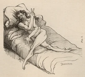 Hysterical epilepsy, attack, contortions, fig. 3 from 
