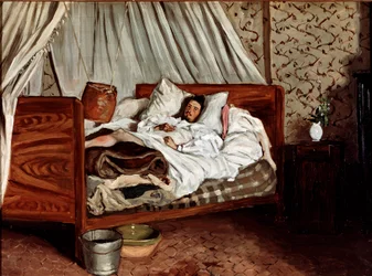 The improvised ambulance (Claude Monet wounded). Painting by Jean Frédéric Bazille (1841-1870)